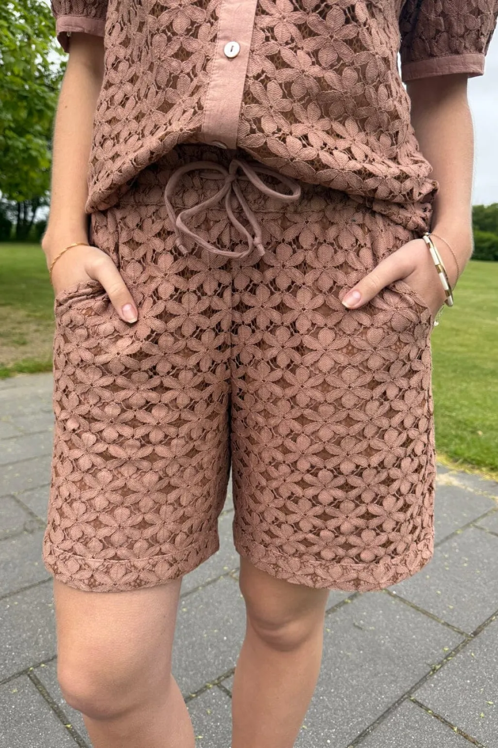 Colis Lace Shorts 15290